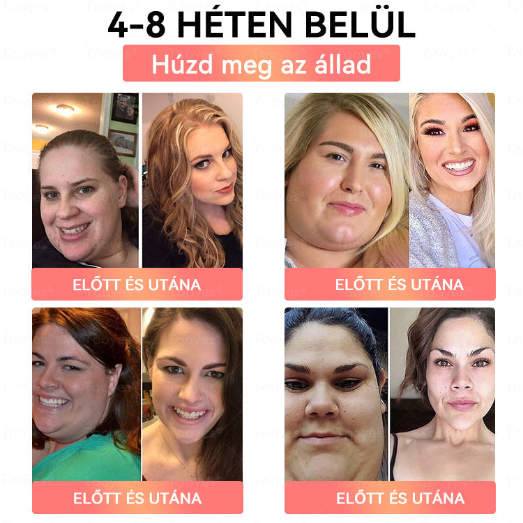 🎁 Már csak 5 doboz maradt. Most extra 70% kedvezményt adunk! Vigyázz az alakodra. Ha most kihagyod, jövőre már nem lesz rá alkalmad! 🎁