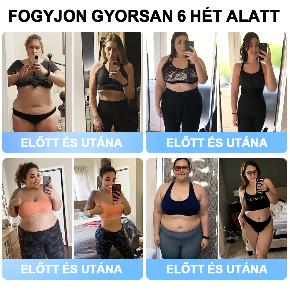 ✅FormaÉlet® 🌱Nano Mikrotű Tapasz SMGT-GLP-1-tel és Matrixyl 3000-rel – Fogyás, Bőrfeszesítés, Vércukorszint-támogatás, Injekció Nélkül, 7 Napos Eredmény