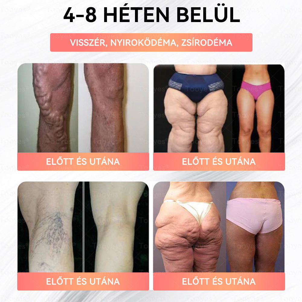 🎁 Már csak 5 doboz maradt. Most extra 70% kedvezményt adunk! Vigyázz az alakodra. Ha most kihagyod, jövőre már nem lesz rá alkalmad! 🎁