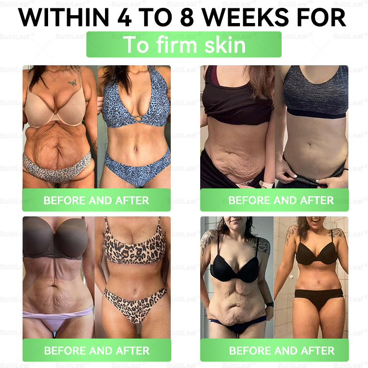 🌿DOOEKA® GLP-1 20-az-1 Slim & Health Orális Oldat – Egyszerű napi használat, látványos eredmény 7 nap alatt, 100 milliárd aktív probiotikummal ✅ testsúlykezelés, szív-, cukorbetegség-, bél- és női egészség, feszes bőr, energia.