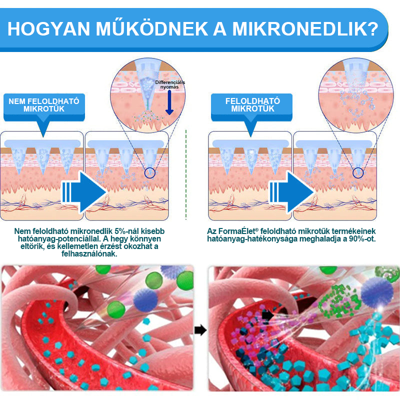 ✅FormaÉlet® 🌱Nano Mikrotű Tapasz SMGT-GLP-1-tel és Matrixyl 3000-rel – Fogyás, Bőrfeszesítés, Vércukorszint-támogatás, Injekció Nélkül, 7 Napos Eredmény