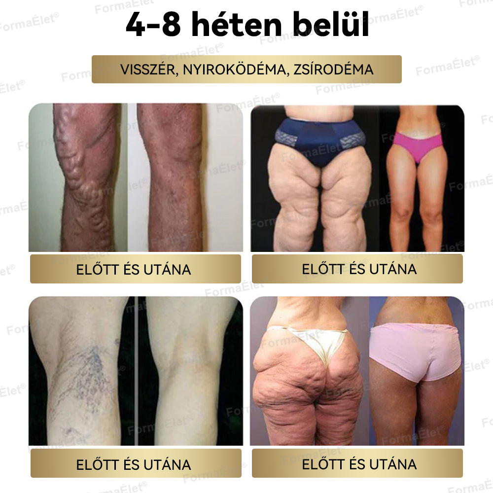 🎁 Már csak 5 doboz maradt. Most extra 50% kedvezményt adunk! Vigyázz az alakodra. Ha most kihagyod, jövőre már nem lesz rá alkalmad! 🎁