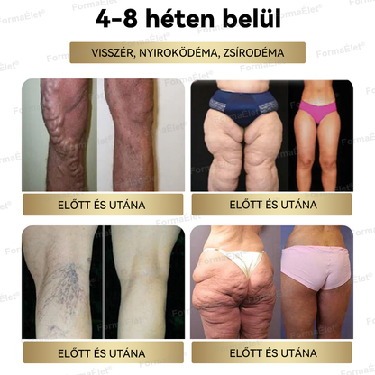 💖A Mayo Clinic által ajánlott | Hivatalos üzlet | FormaÉlet® GLP-1 Moringa Fogyókúrás és Egészségfokozó cseppek 🔥 (Élelmiszer-minőségű zsírégető – Az Obesity Society fejlesztése)