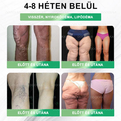 🎁 DOOEKA® GLP-1 8 az 1-ben Fit & Vital Szájon át szedhető oldat – 👨‍⚕️ Napi egyszer, 7 nap alatt látható változás 🎁