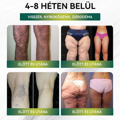 🎁Mayo Klinika által ajánlott | Hivatalos áruház | Buildleaf® SMGT-GLP-1 Nano Mikrotű Tapasz™ Kollagénnel és Matrixyl 3000-rel 丨Célzott hatás: elhízás, megereszkedett bőr, magas vérnyomás, cukorbetegség, zsírmáj, testi fájdalmak és egyéb problémák ellen🎁